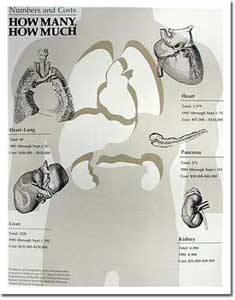 Illustration for chart on organ transplants for Research News issue on organ transplants 